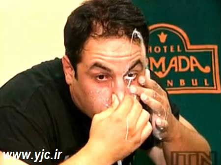 شلیک شیر از چشم