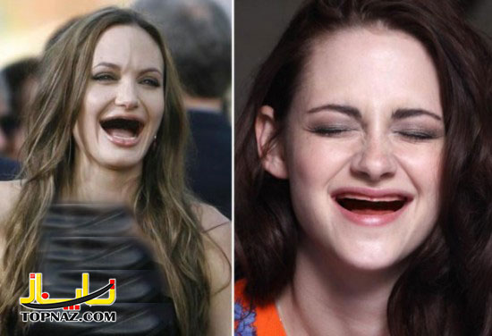 زنان هالیوودی بدون دندان