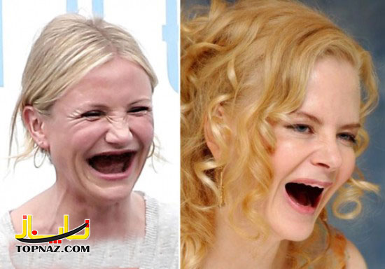 زنان زیبای هالیوودی بدون دندان 