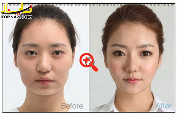 عکسهای جالب از جراحی زیبابی در کره جنوبی!