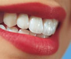 دندان سفید, مسواک و دندان سفید