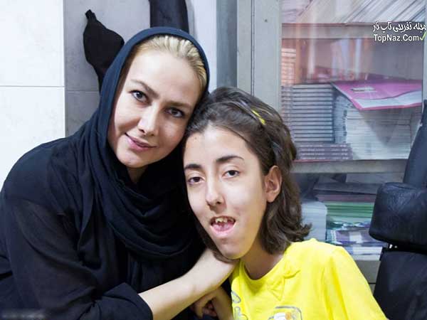 عکس های عیادت آنا نعمتی از کودکان دیستروفی عکس های عیادت آنا نعمتی از کودکان دیستروفی
