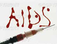 نحوه تشخصی و راه های انتقال ایدز Aids