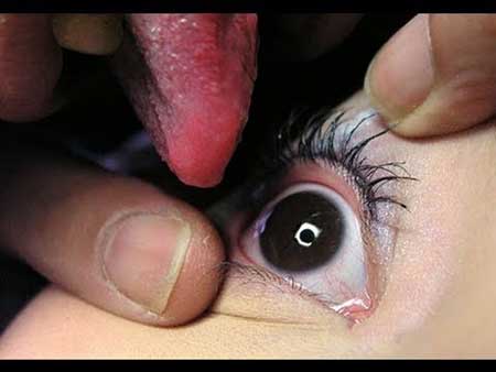 درمان بیماری چشم با لیسیدن!