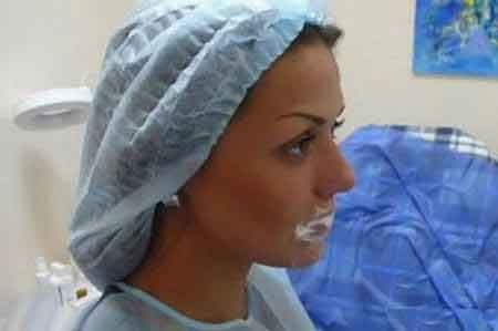 جراحی های وحشتناک زیبایی روی صورت دختر جوان!