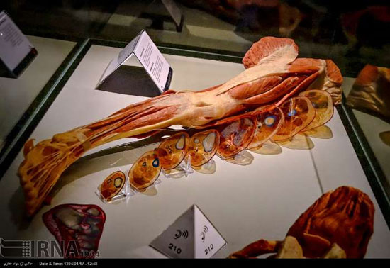 عکس های موزه ای با بدن انسان های مرده و خشک شده!