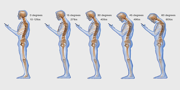 Looking Down At Your Phone Is Harming Your Neck
