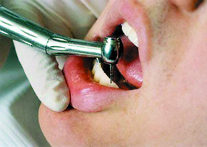 مراقبت های دندان پس از ترمیم و پر کردن