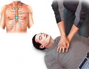 آموزش احیای قلبی و دادن تنفس مصنوعی CPR