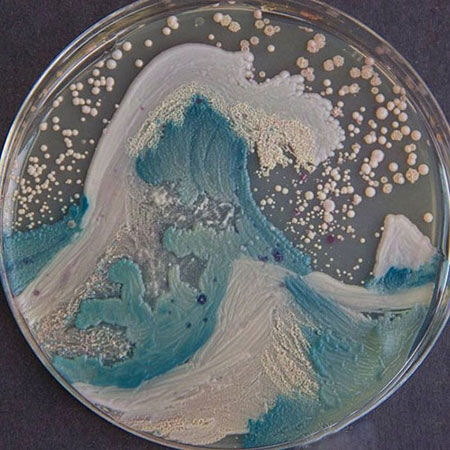 عکس های زیباترین میکروب های جهان!