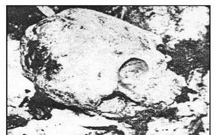 عکس از استخوان جمجمه نادر شاه افشار بعد از نبش قبر