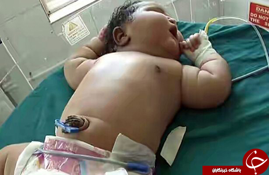 تپل ترین نوزاد دنیا متولد شد! +عکس نوزاد و مادر
