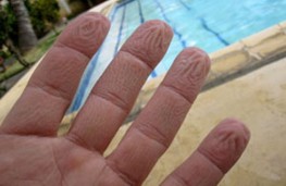 دلیل چروک شدن پوست دست در آب چیست؟