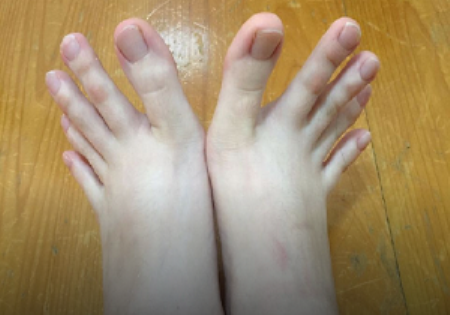 عکس های دختری که انگشتان پایش بسیار دراز است! 