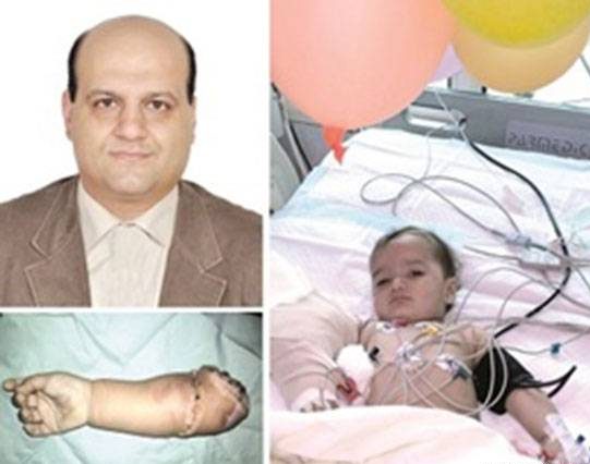 پیوند دست قطع شده نوزاد 13 ماهه در شیراز + عکس پیوند دست قطع شده نوزاد 13 ماهه در شیراز + عکس