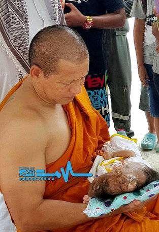 عکس های نوزاد دختری با ناهنجاری شدید و دردناک در اغوش یک راهبه (تصاویر 18+)