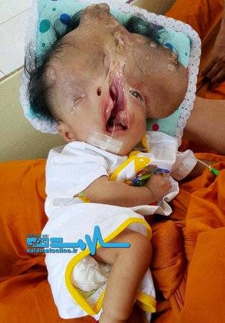 عکس های نوزاد دختری با ناهنجاری شدید و دردناک در اغوش یک راهبه (تصاویر 18+)