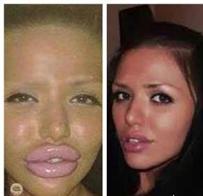 این دختر زیبا به دلیل عمل جراحی زیبایی چهره اش ترسناک شد!