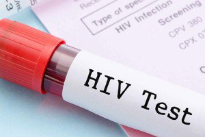 روش تشخیص سریع ابتلا به ایدز و هپاتیت ممکن شد