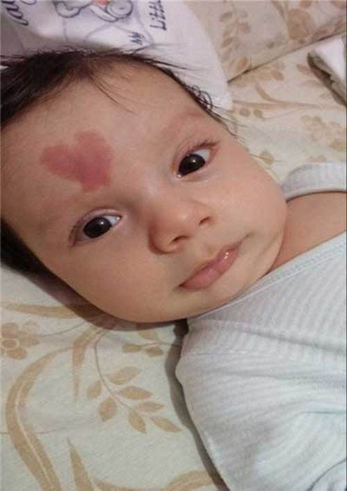 علامت و نشانه عشق بر روی پیشانی این نوزاد که جنجالی شد! + عکس