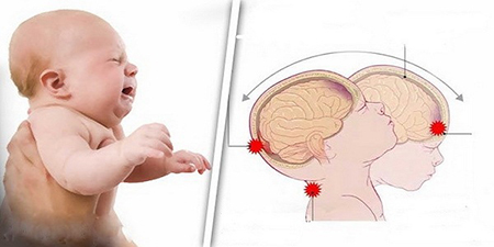 نوزاد را هرگز تکان شدید ندهید زیرا مغزش آسیب می بیند!