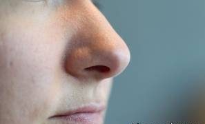 ضررهای وارد شده به بینی پس از عمل جراحی 