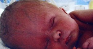 ماجرای معجزه برای نوزادی که بدون مغز متولد شد!