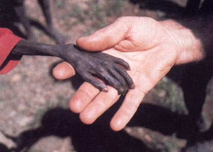 گرسنگان آفریقا