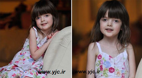 بیماری عجیب دختر