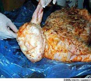 بره با سر انسان