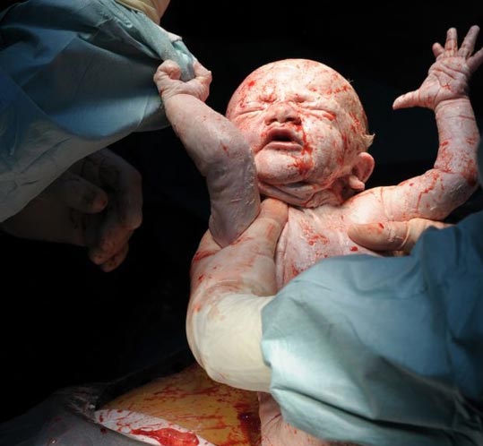 تولد نوزاد انسان