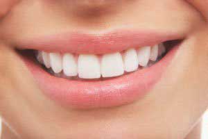 داشتن دندان های سفید در کمترین زمان 1