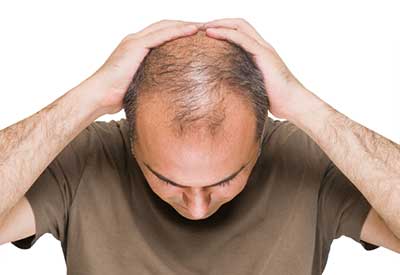 از ریزش مو خسته شده اید؟ این 14 نکته را برای جلوگیری از ریزش مو رعایت کنید 1