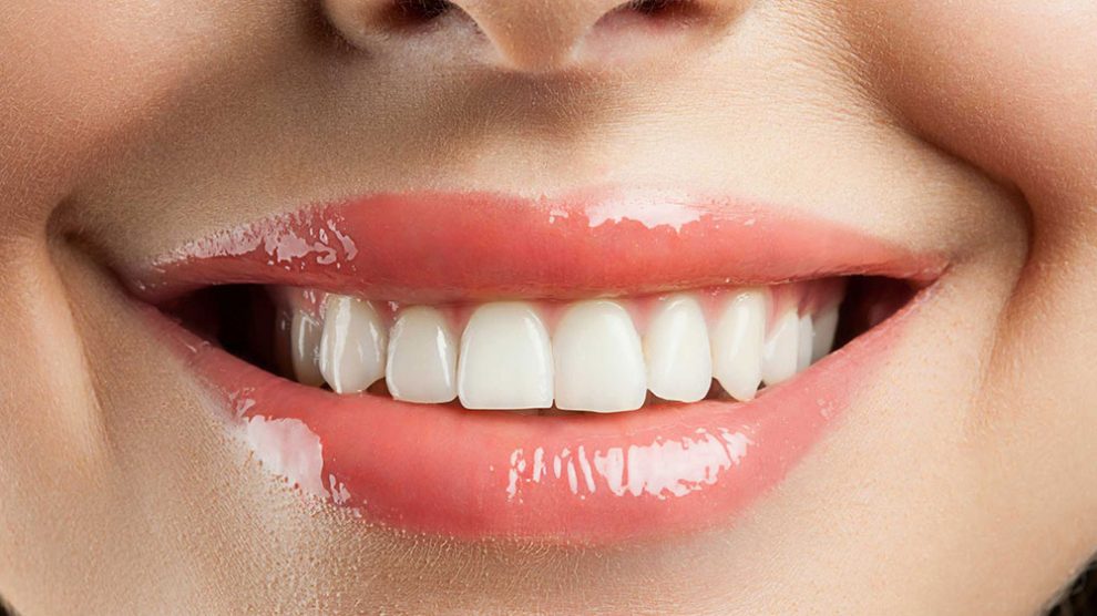 9 عاملی که باعث می شود دندان های سفید شما لکه دار شود 1