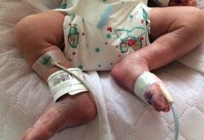 پیدا شدن جسد نوزاد در یخچال معمولی بیمارستان!