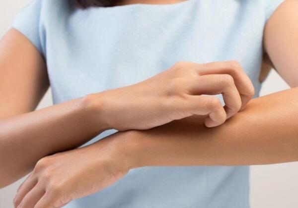 درمان انواع حساسیت پوستی با روش های طبیعی در منزل