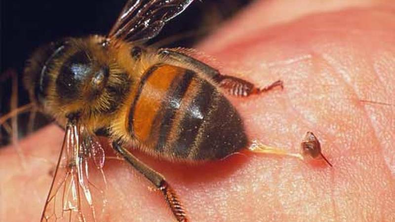 درمان زنبور گزیدگی با استفاده از روش های خانگی و موثر