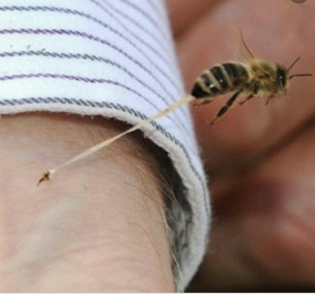 درمان زنبور گزیدگی با استفاده از روش های خانگی و موثر