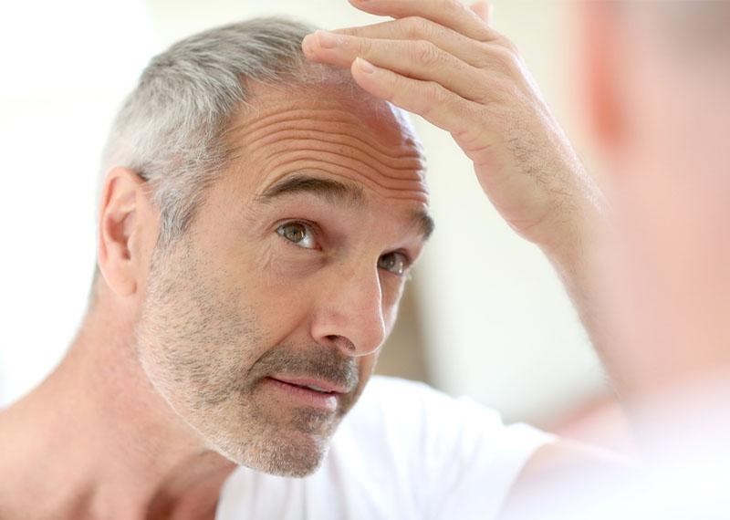 چگونه ریزش مو را متوقف کنیم؟
