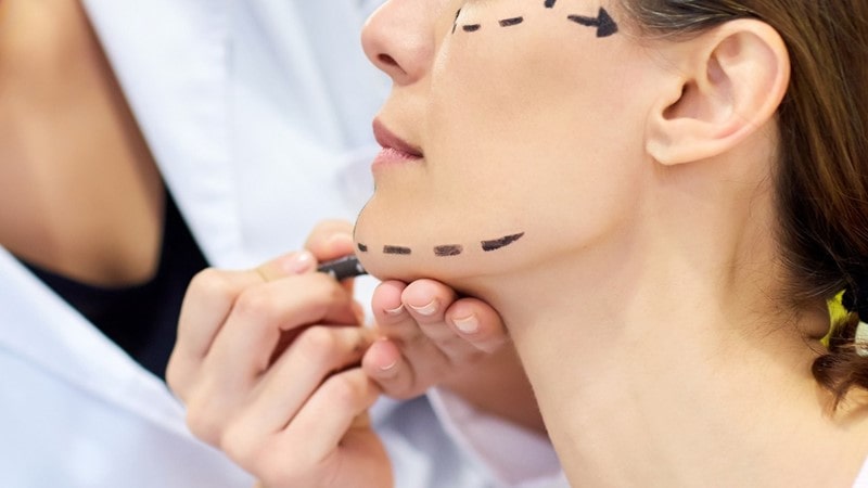 لیفتینگ صورت؛ با جراحی یا بدون جراحی؟